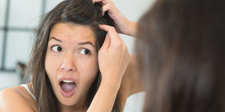 12 Effective Natural Treatments To Get Rid Of Dandruff
